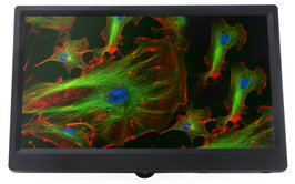 Display with mounting system on BMS camera